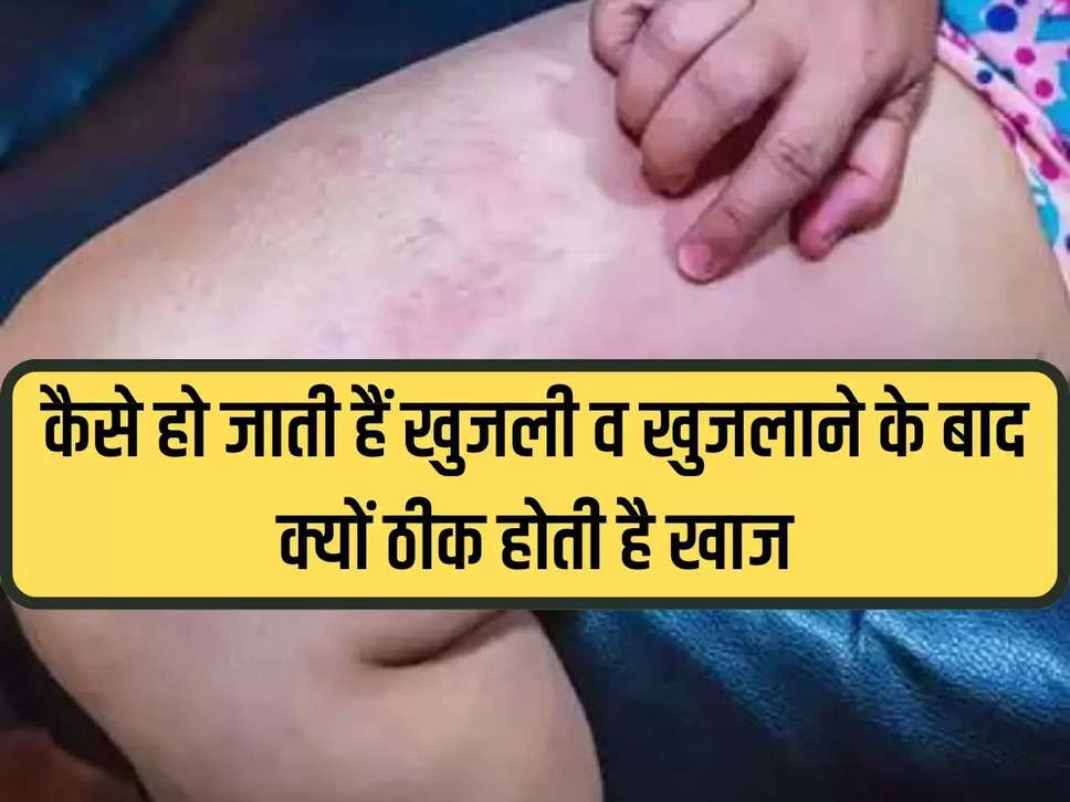 Itching Cures: How itching occurs and why itching gets cured after scratching, know the reason