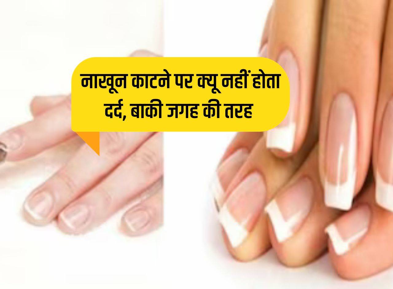 नाखूनों का पीलापन करना है दूर, तो ये तरीके आपके काम आ सकते हैं | Yellowing  of nails is to be removed then these methods can be useful for you | TV9  Bharatvarsh