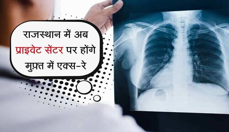 राजस्थान में अब प्राइवेट सेंटर पर होंगे मुफ़्त में एक्स-रे, राज्य के लोगों को मिलेगा फायदा