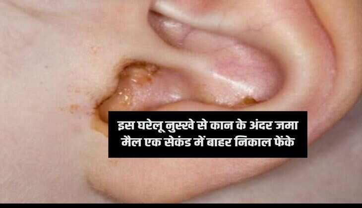 इस घरेलू नुस्खे से कान के अंदर जमा मैल एक सेकंड में बाहर निकाल फेंके