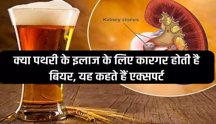 Is beer effective in treating stones, say experts